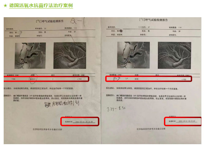 突然有口气，是得了幽门螺杆菌吗？