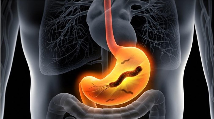 可能导致胃癌的细菌，一半中国人都感染了！该如何应对？